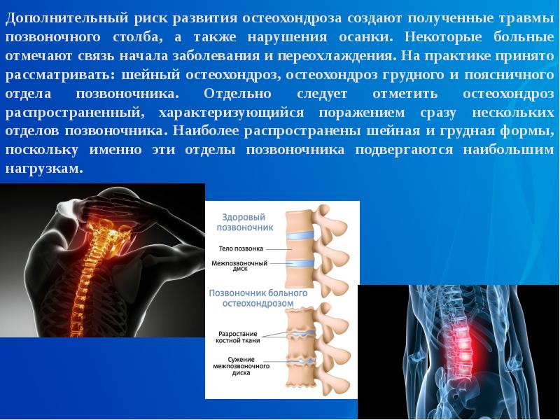 Виды нарушений опорно двигательного аппарата презентация