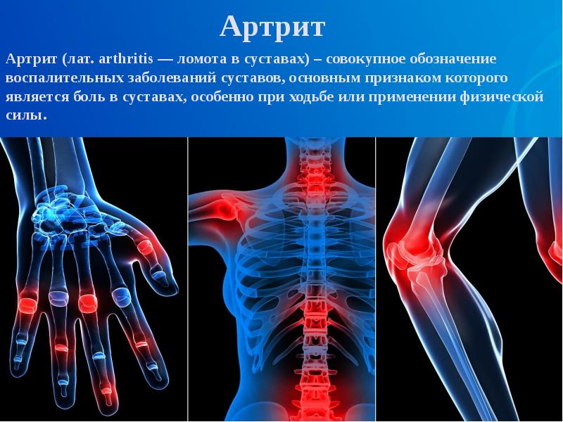 Пороки развития опорно двигательного аппарата презентация