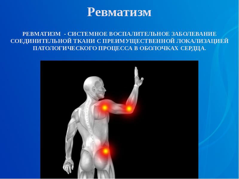 Ревматизм презентация по педиатрии