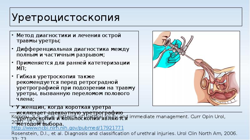 Травмы уретры презентация