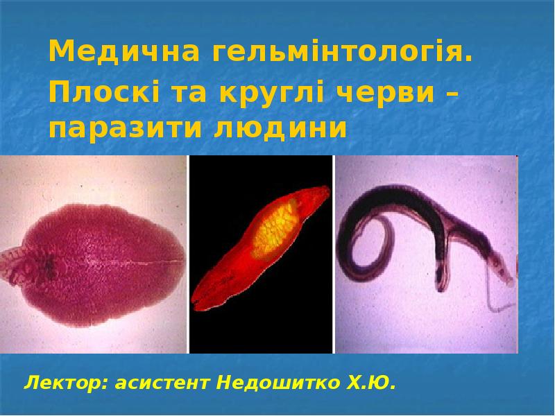 Медична гельмінтологія.  Плоскі та круглі черви – паразити людини