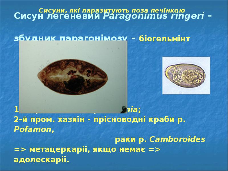 Сисун легеневий Paragonimus ringeri –  збудник парагонімозу - біогельмінт