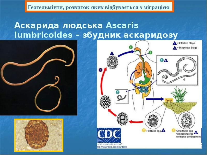 Аскарида людська Ascaris lumbricoides – збудник аскаридозу