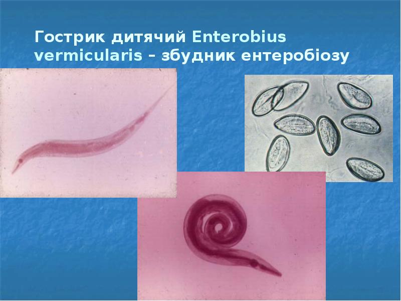 Гострик дитячий Enterobius vermicularis – збудник ентеробіозу