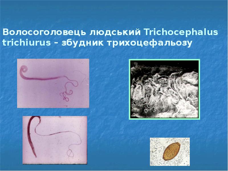 Волосоголовець людський Trichocephalus trichiurus – збудник трихоцефальозу