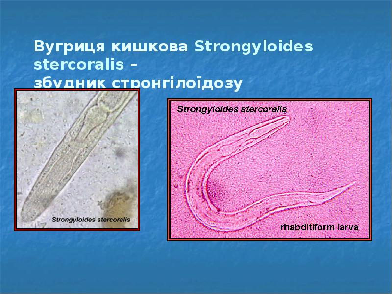 Вугриця кишкова Strongyloides stercoralis –  збудник стронгілоїдозу