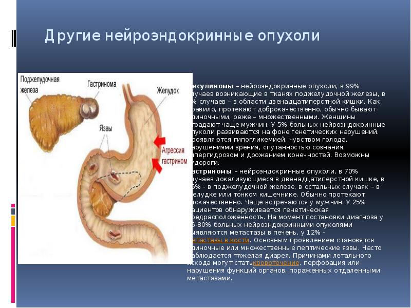 Нейроэндокринная опухоль симптомы