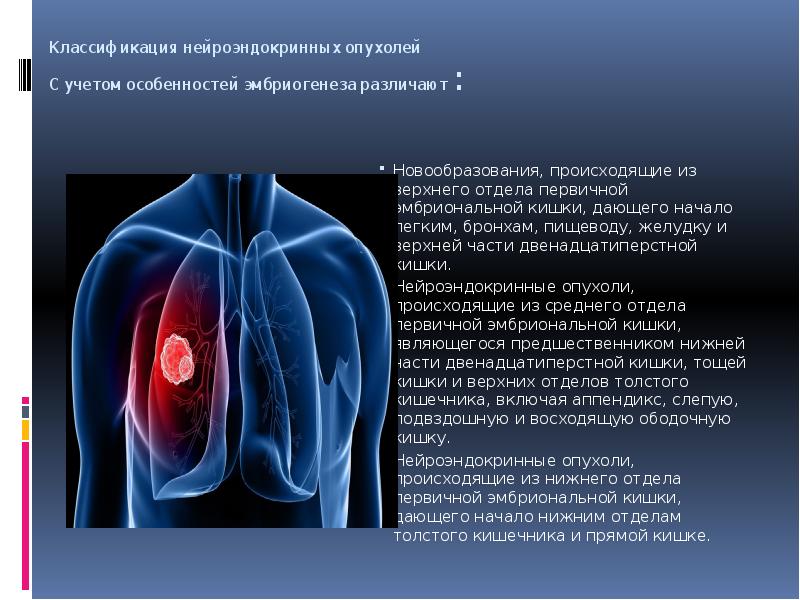 Презентация по опухолям