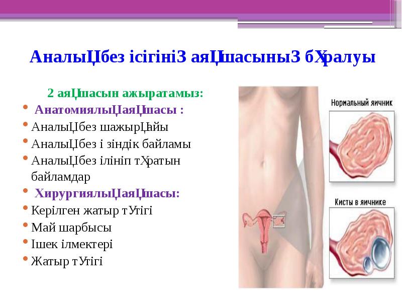 Аналық без ісігінің аяқшасының бұралуы
2 аяқшасын ажыратамыз:
Анатомиялық аяқшасы Аналық без ісігінің аяқшасының бұралуы
2 аяқшасын ажыратамыз:
Анатомиялық аяқшасы