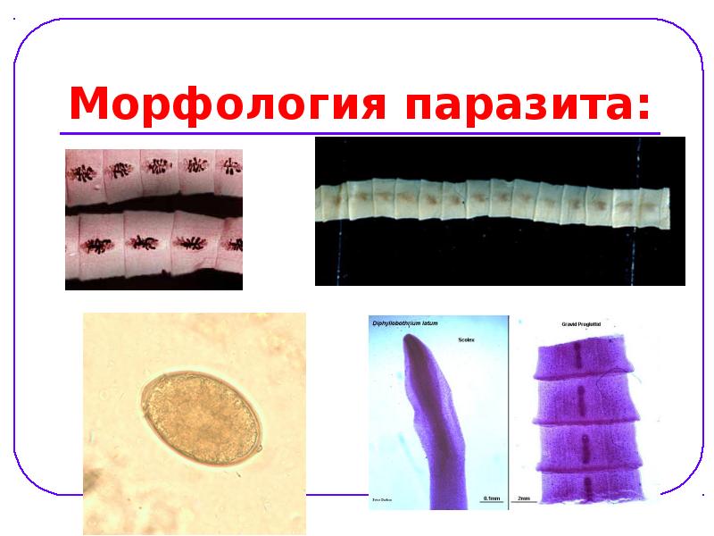Морфология паразита: Морфология паразита: