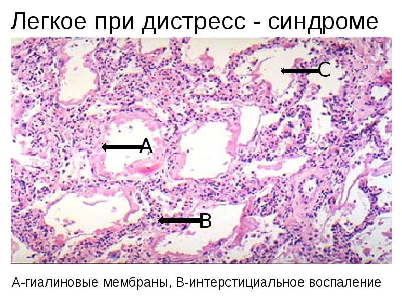 Морфологическая картина что это такое