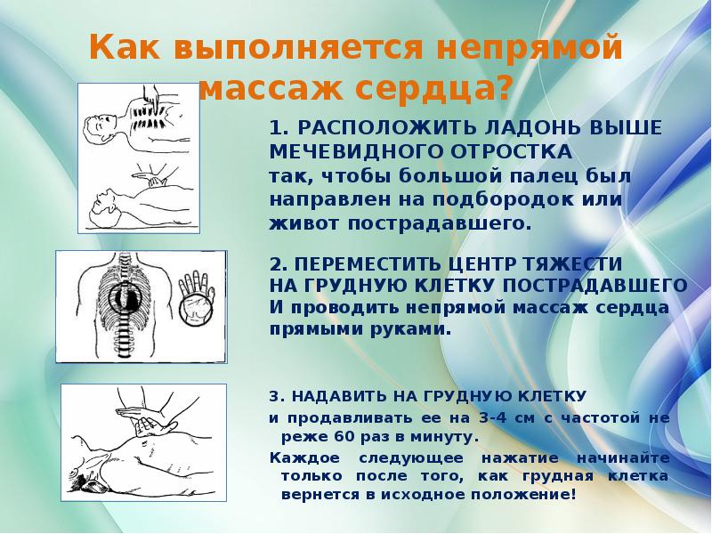 Какие действия выполняются при непрямом массаже. Какие действия выполняются при непрямом массаже. Какие действия выполняются при непрямом массаже. Порядок выполнения непрямого массажа сердца. Непрямой массаж сердца алгоритм действий кратко.